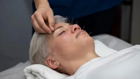 AcupunctureforAnxietyRelief.webp.65d64b1d890855851a5c456f53158d62.webp